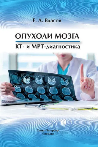 Обложка книги «Опухоли мозга. КТ- и МРТ-диагностика»