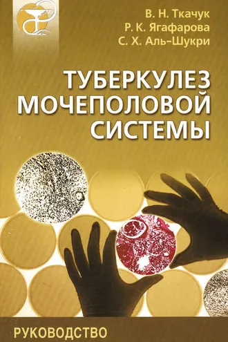 Обложка книги «Туберкулез мочеполовой системы. Руководство»