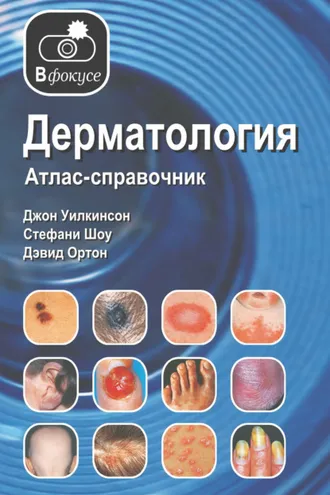 Обложка книги «Дерматология. Атлас – справочник»