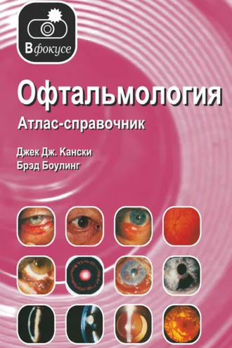 Обложка книги «Офтальмология. Атлас – справочник»