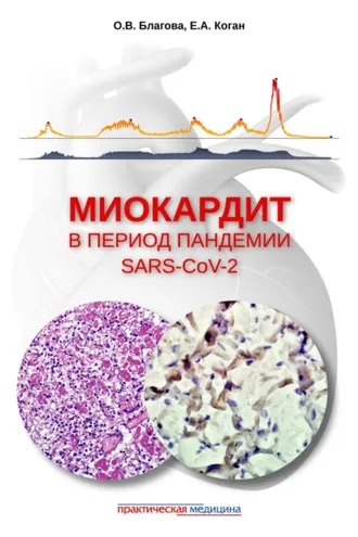 Обложка книги «Миокардит в период пандемии SARS-CoV-2»