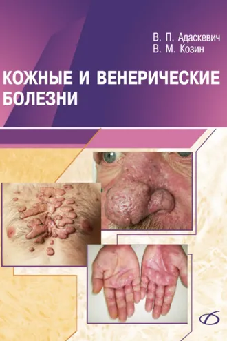 Обложка книги «Кожные и венерические болезни»