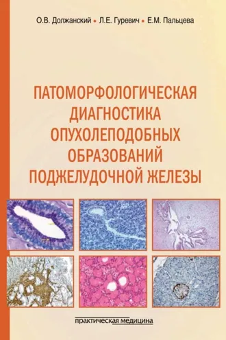 Обложка книги «Патоморфологическая диагностика опухолеподобных образований поджелудочной железы. Руководство для врачей»