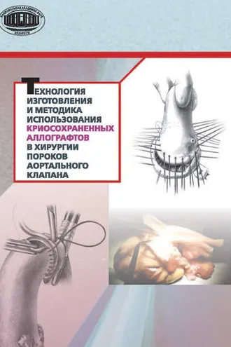 Обложка книги «Технология изготовления и методика использования криосохраненных аллографтов в хирургии пороков аортального клапана»