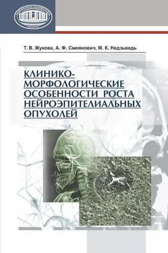 Обложка книги «Клинико-морфологические особенности роста нейроэпителиальных опухолей»