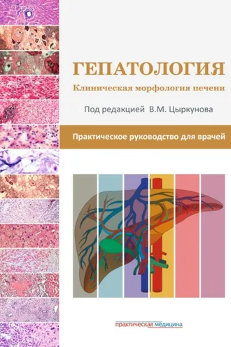 Обложка книги «Гепатология. Клиническая морфология печени. Практическое руководство для врачей»