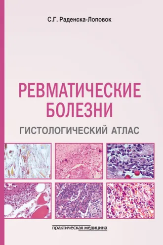 Обложка книги «Ревматические болезни. Гистологический атлас»
