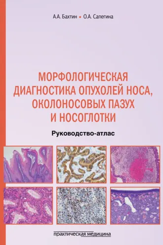 Обложка книги «Морфологическая диагностика опухолей носа, околоносовых пазух и носоглотки»