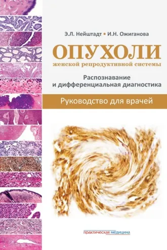 Обложка книги «Опухоли женской репродуктивной системы. Распознавание и дифференциальная диагностика. Руководство для врачей»