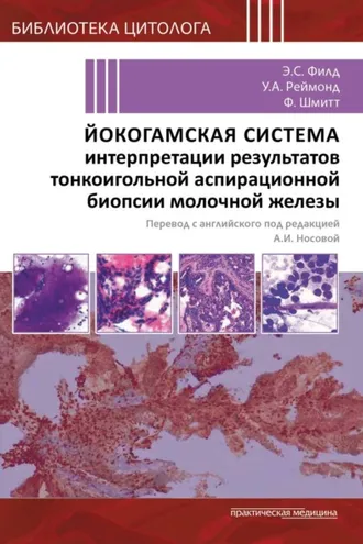 Обложка книги «Йокогамская система интерпретации результатов тонкоигольной аспирационной биопсии молочной железы»